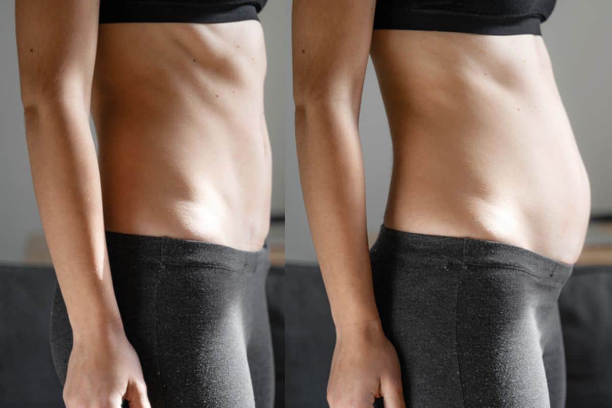 How long does diastasis recti take to improve Handsworth?