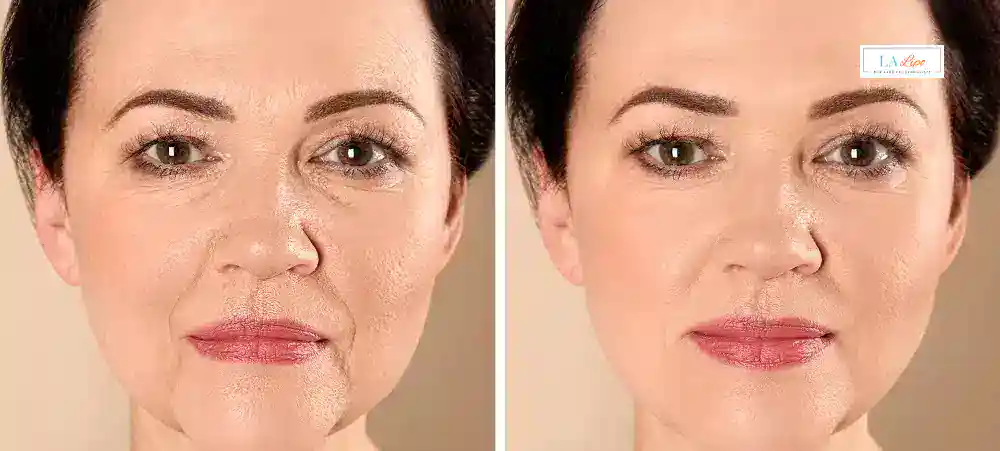 How Long Does It Take to See Results and How Long Do They Last Handsworth?