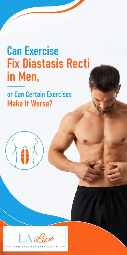 Can Exercise Fix Diastasis Recti in Men, or Can Certain Exercises Make It Worse Handsworth?